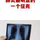 湖北零新增︰(湖北新增4823例新冠肺炎)