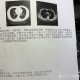 「丰台新增1例境外输入」〃丰台出现一例新型肺炎