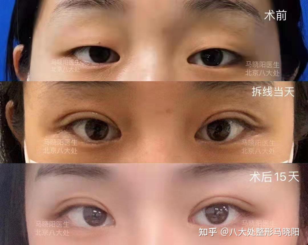 【合肥美的确诊病例/合肥美的死人】-第1张图片