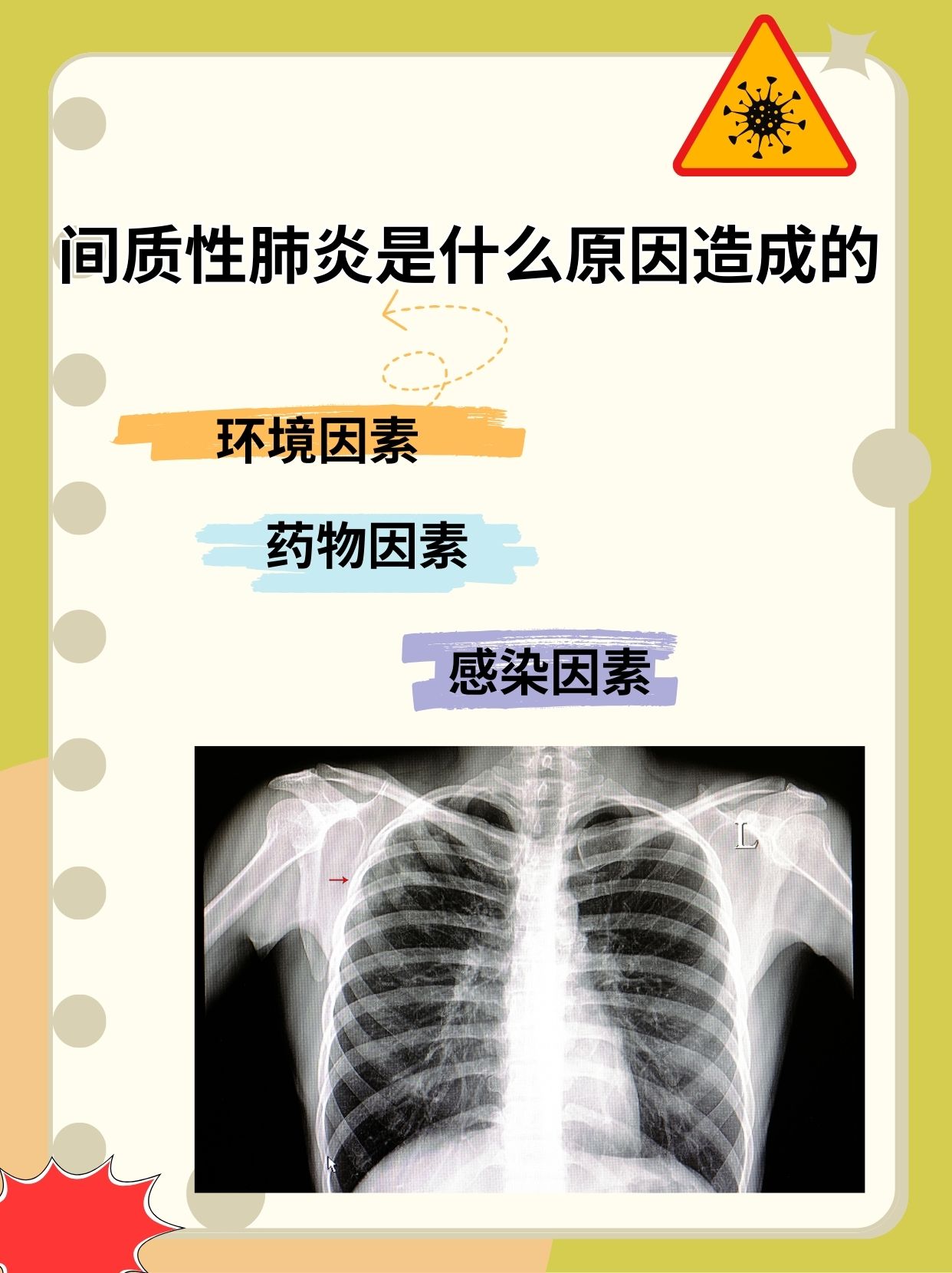 “2019年新型肺炎爆发	” 2019新型肺炎叫什么名字？-第2张图片