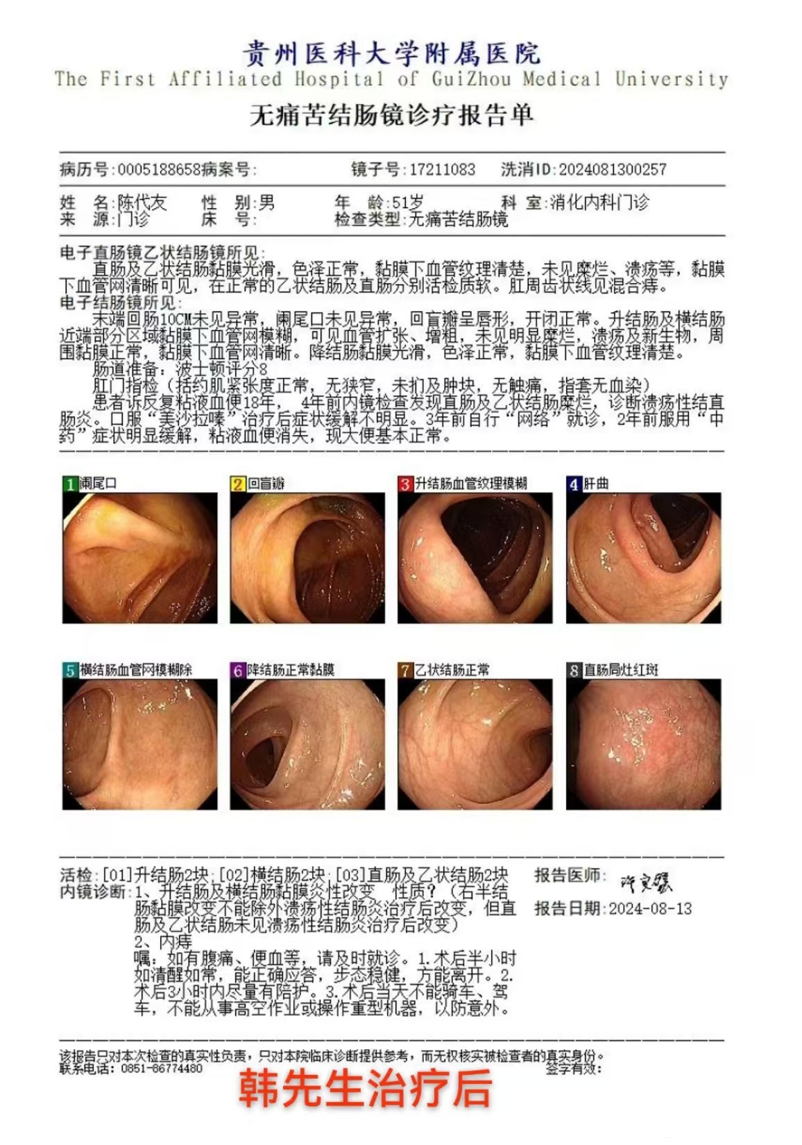 贵州新增2例本土确诊病例.贵州新增1例-第1张图片
