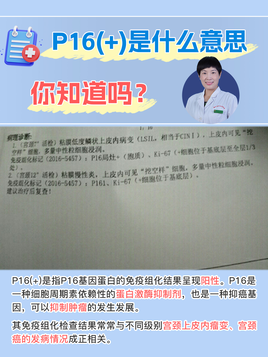 专家解读国内首例奥密克戎变异株.奥密克戎读音-第2张图片