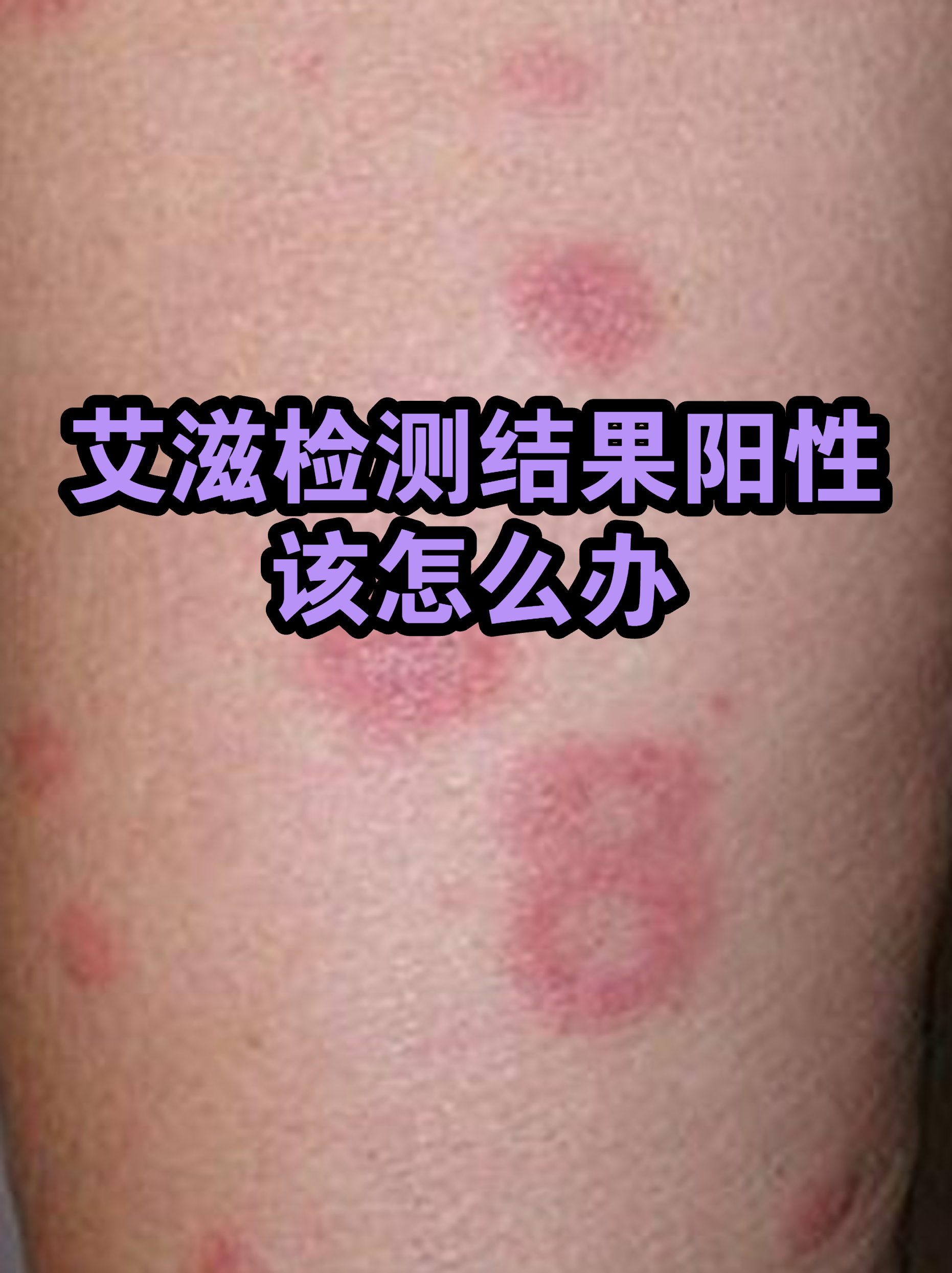 “江苏无锡发现31名阳性人员	” 无锡确诊阳性？-第1张图片